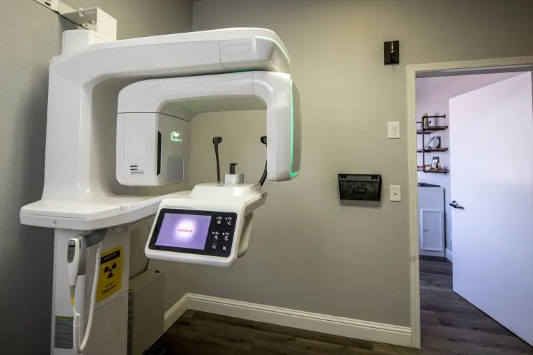 3D Scanner