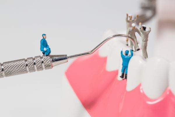 Dental Implant Maintenance