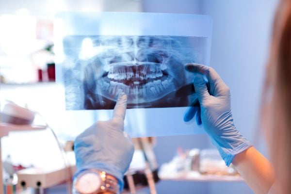 Image of an x-ray