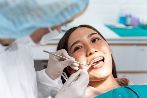 Image of smiling woman with braces