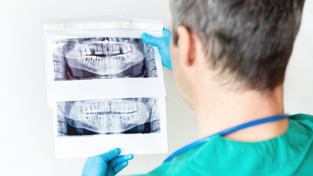 Oral Surgeon examining an x-ray of a person's mouth and teeth