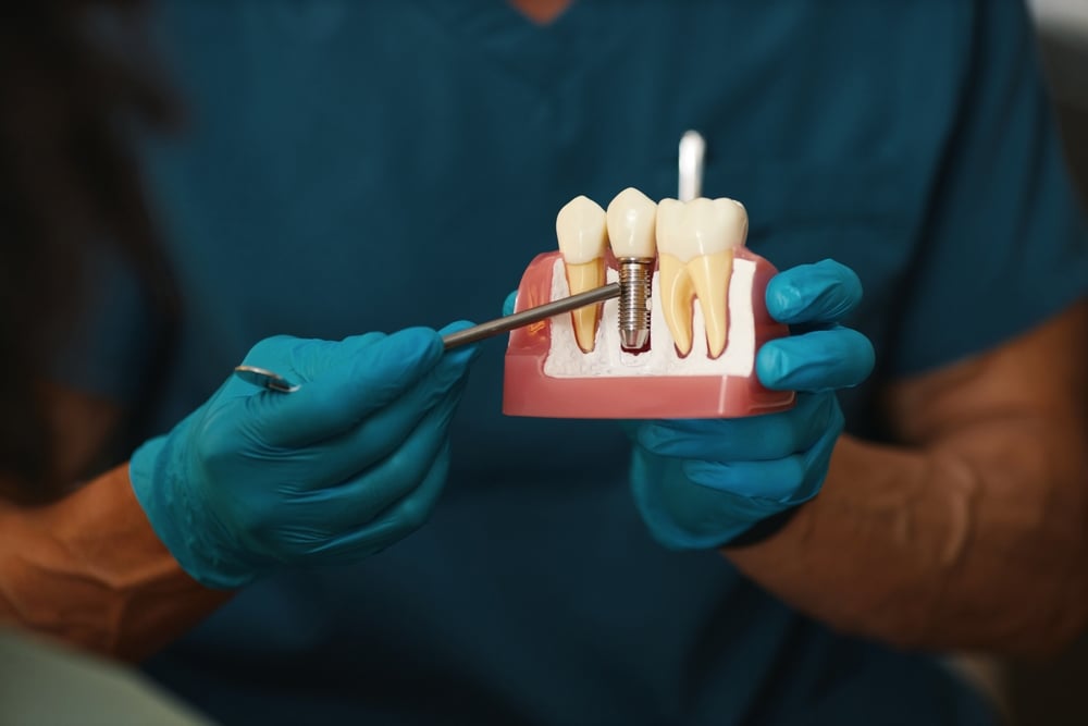 Doctor pointing to a display of two natural teeth with a dental implant tooth in the middle