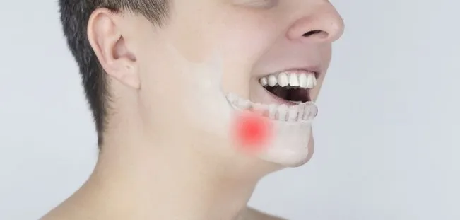 Schematic representation of pain in the jaw. Augmented reality. An x-ray of the jaw bone superimposed on a photograph. Painful areas are highlighted in red.