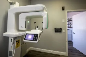 3D Scanner