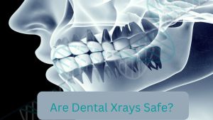 Illustrated example of Dental Xrays