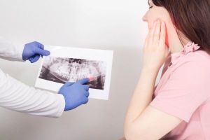 Wisdom Tooth Removal xray image