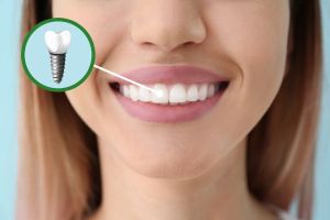 Young Woman with Dental Implant