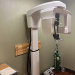 3D scanner
