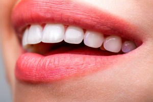 woman's smile